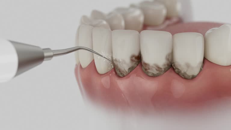 Reliable Dental contractor in Magalia, CA by Smile Center Dentistry